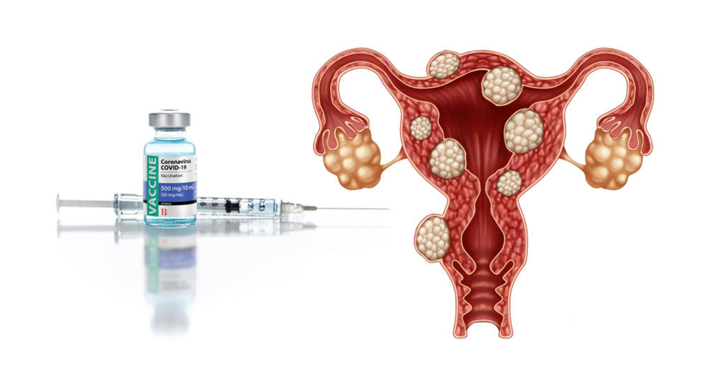 COVID-19 Menstrual & Breast Milk Disruptions, Miscarriages, Infertility, Shedding, DNA Contamination
